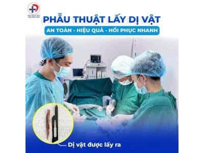 Dị vật xương cá – Vết thương nhỏ, nguy hiểm lớn