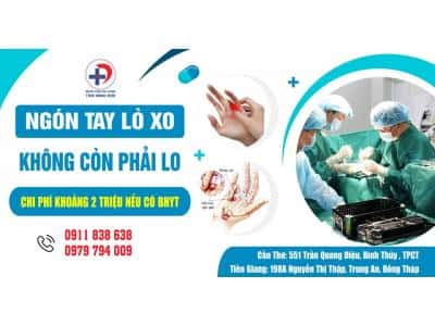 NGÓN TAY LÒ XO – ĐỪNG ĐỂ ẢNH HƯỞNG CUỘC SỐNG