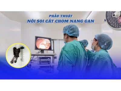 Phẫu thuật nội soi cắt chỏm nang gan 