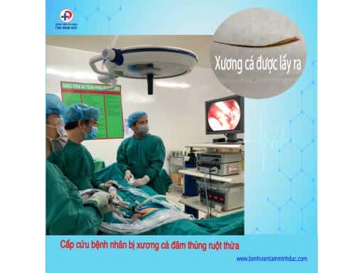 PHẪU THUẬT NỘI SOI CẤP CỨU BỆNH NHÂN BỊ XƯƠNG CÁ ĐÂM THỦNG RUỘT THỪA