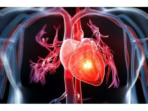 TẦM SOÁT BỆNH LÝ TIM MẠCH