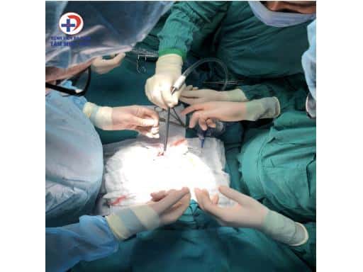 BVTMĐ – PHẪU THUẬT THÀNH CÔNG KHỐI U NẶNG HƠN 7 KG